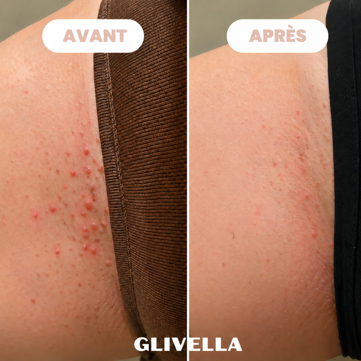 Rasoir Bikini Glivella™
