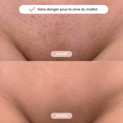Rasoir Bikini Glivella™