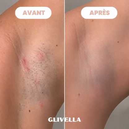 Rasoir Bikini Glivella™