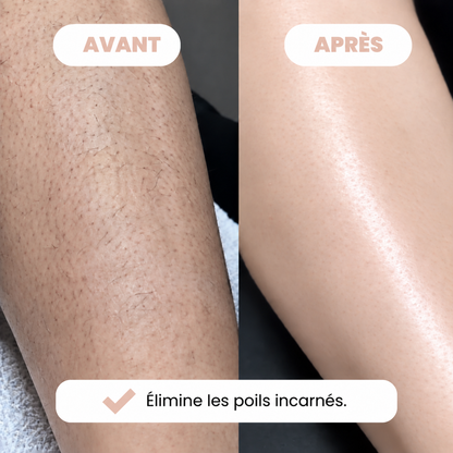 Rasoir Bikini Glivella™